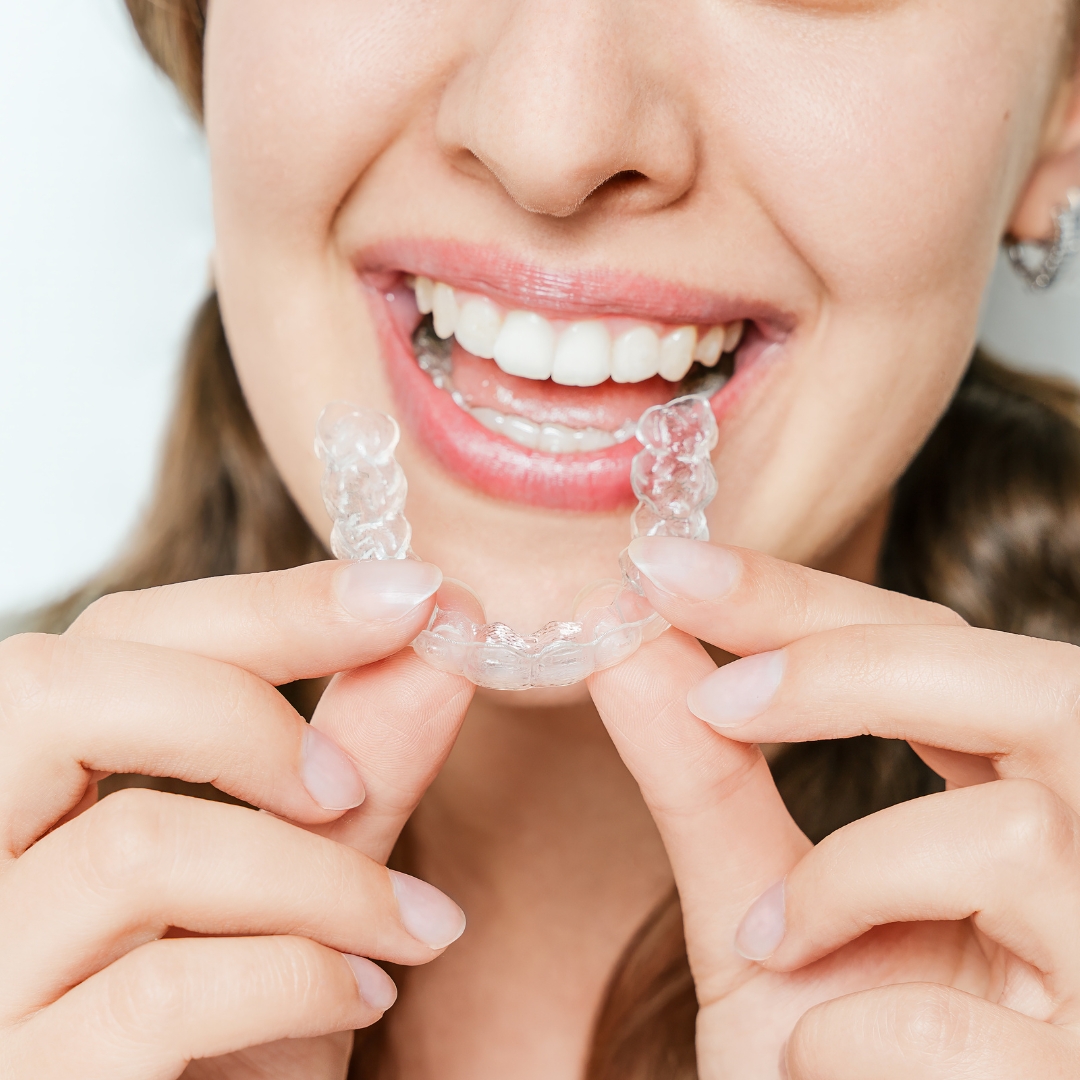 Invisalign clear aligner system