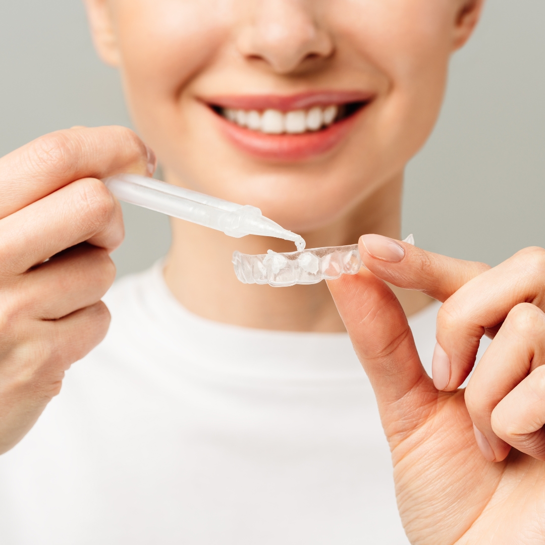 Bright, white smile after professional teeth whitening treatment