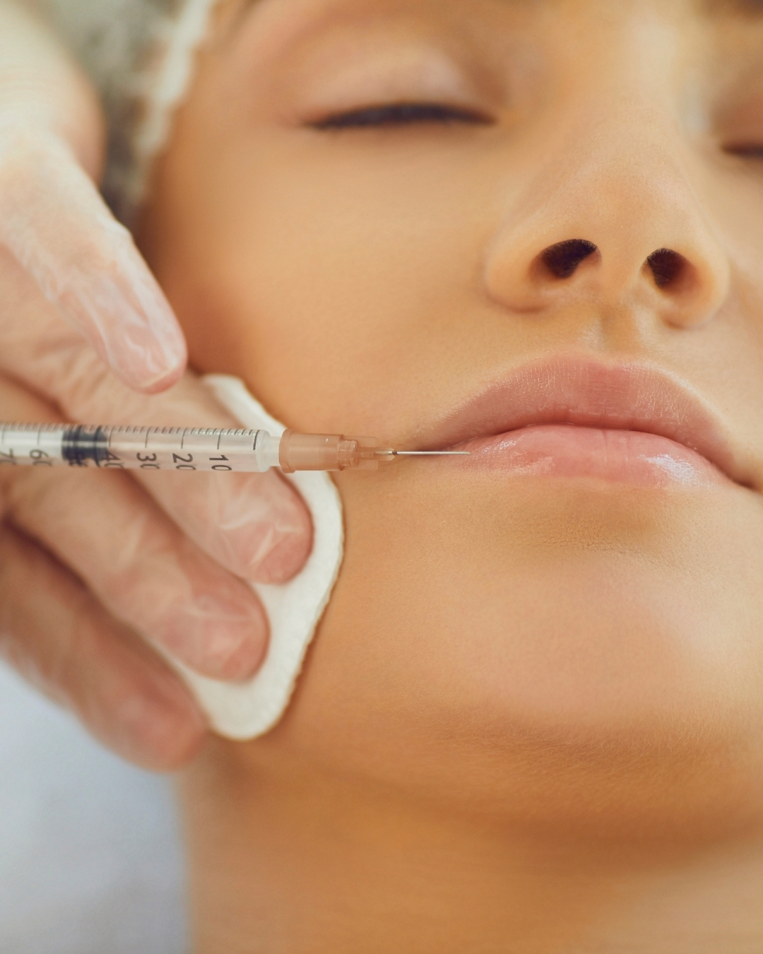Dr May Abdulla performing dermal filler treatment at Open Beauty Islington