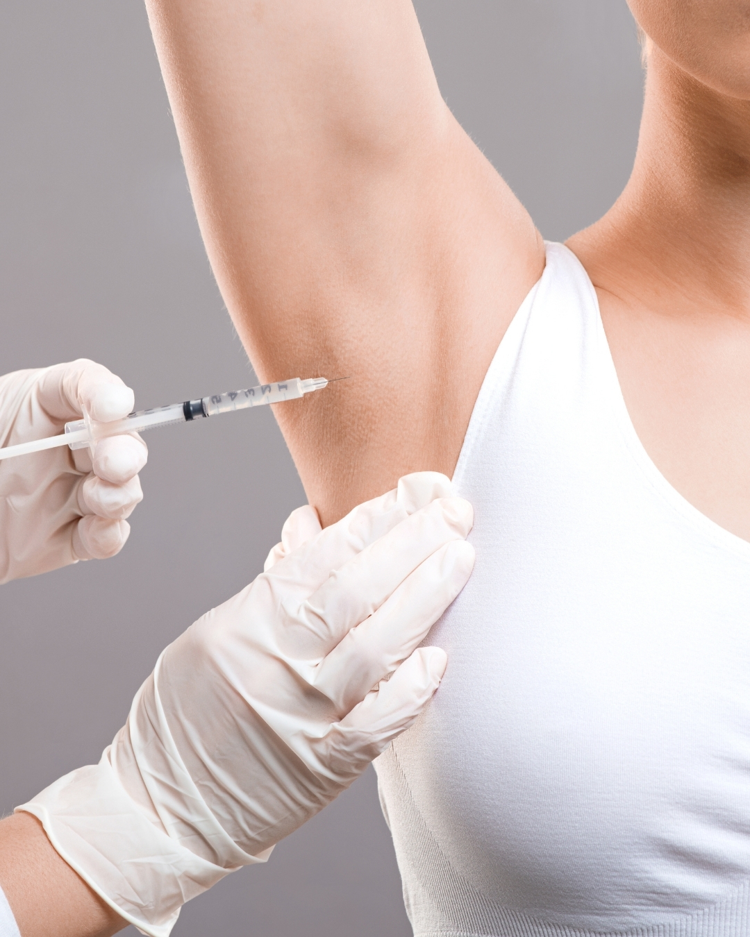 Hyperhidrosis SWEATOX treatment at Open Beauty Islington
