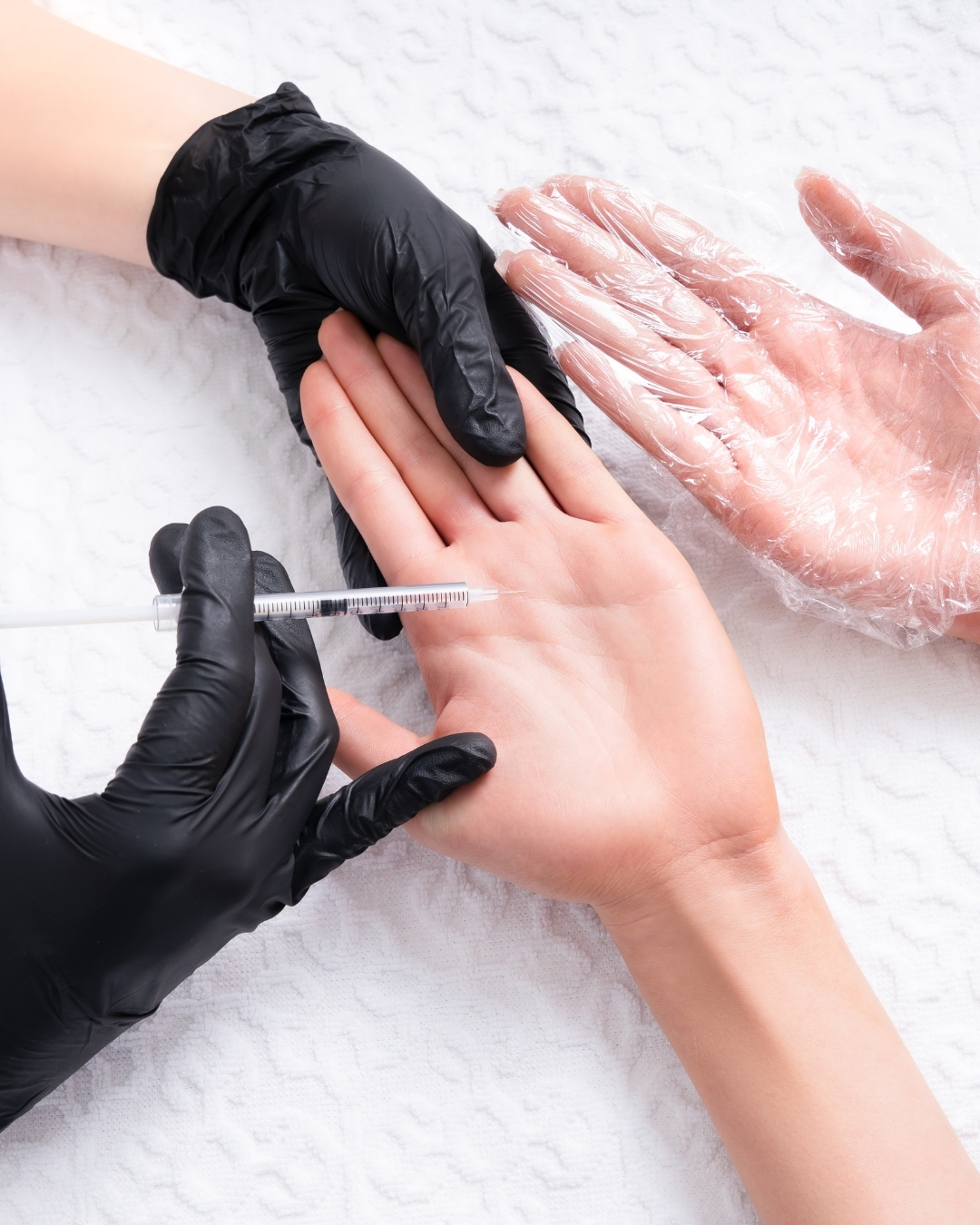 SWEATOX hyperhidrosis treatment at Open Beauty Islington