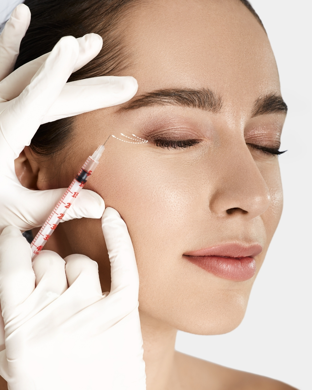 Wrinkle reduction treatment timeline at Open Beauty Islington